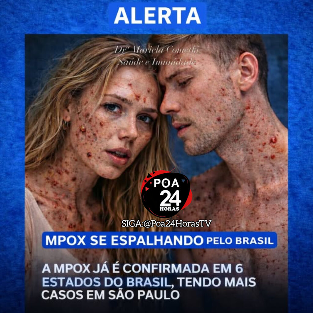 ALERTA DO AUMENTO DO VIRÚS MPOX EM VÁRIOS ESTADOS DO BRASIL